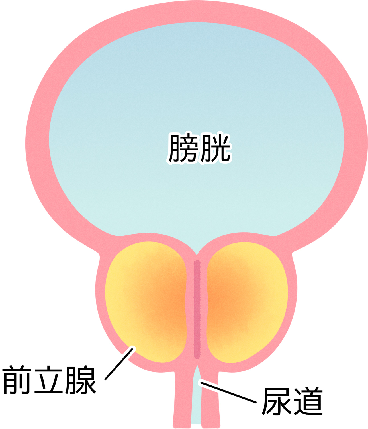 前立腺肥大症