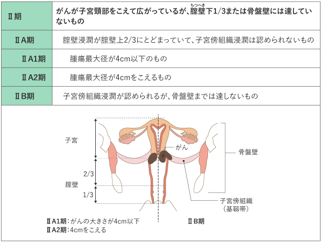 子宮頸がん