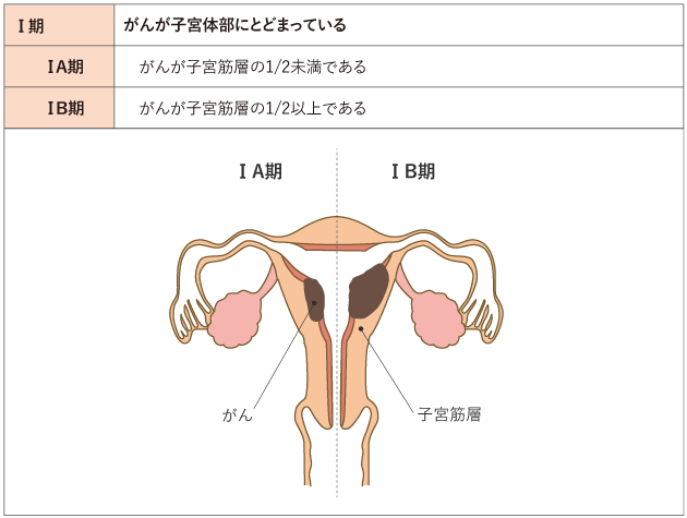 子宮体がん