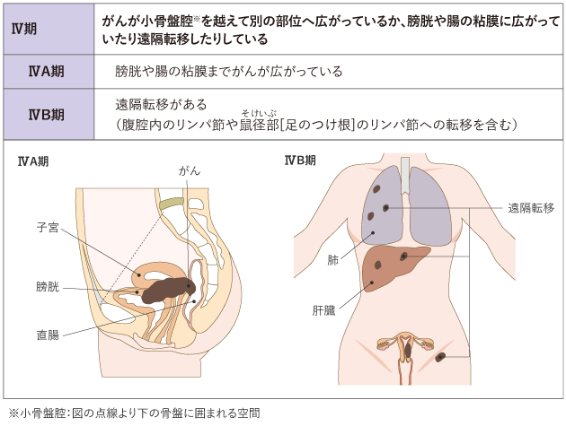 子宮体がん